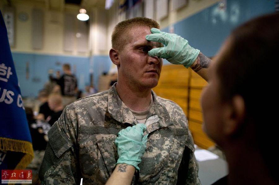 军医给受伤士兵检查眼眶。